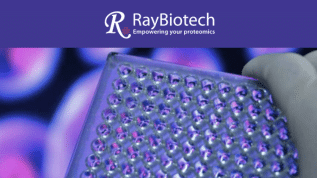 Discover 25% Off RayBiotech ELISA Kits* – Where Precision Meets Value