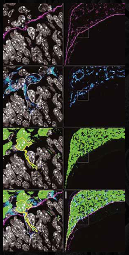 Spatial Biology Secondary